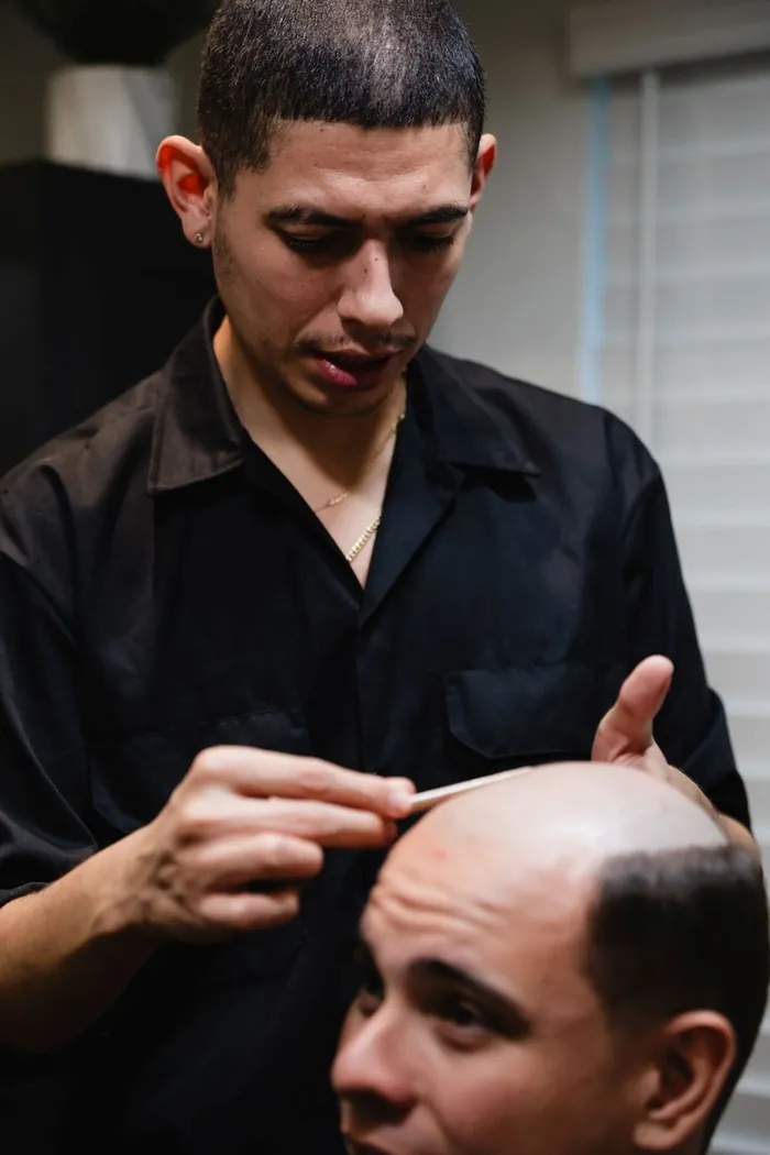 Specialist measuring and marking the hairline on a client with hair loss before a hair replacement system is fitted