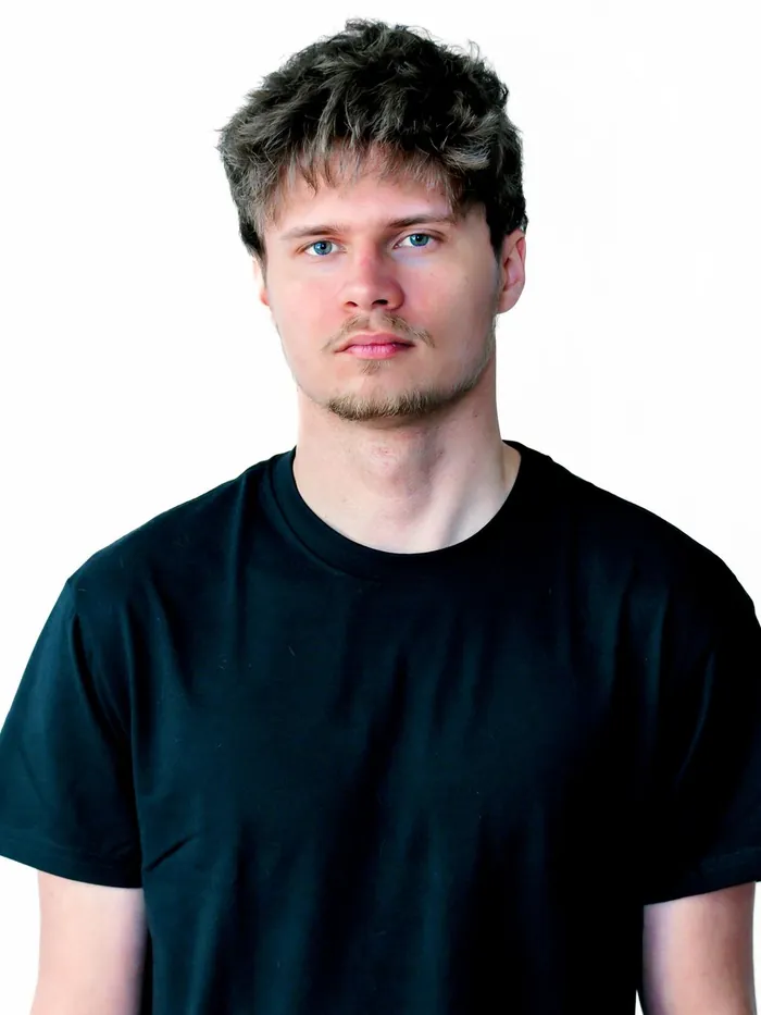 After: longer textured hair with a rebuilt hairline from a mens hair system, front view