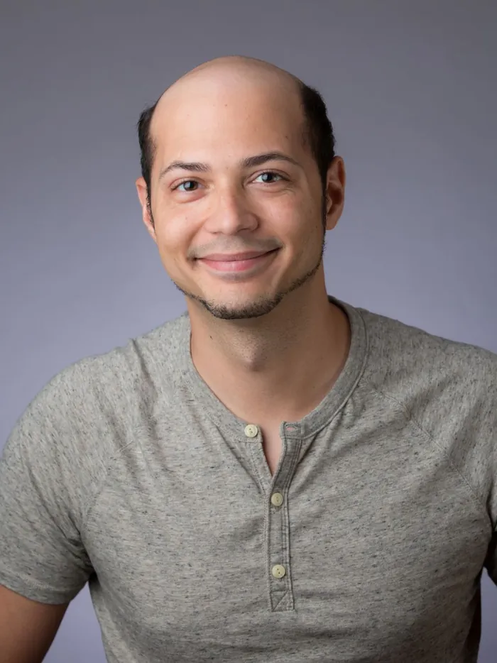 Before: completely bald scalp, front view