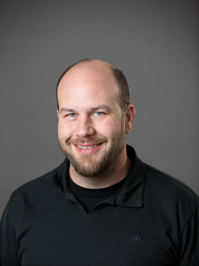 Before: bald crown and front with a full beard, front view