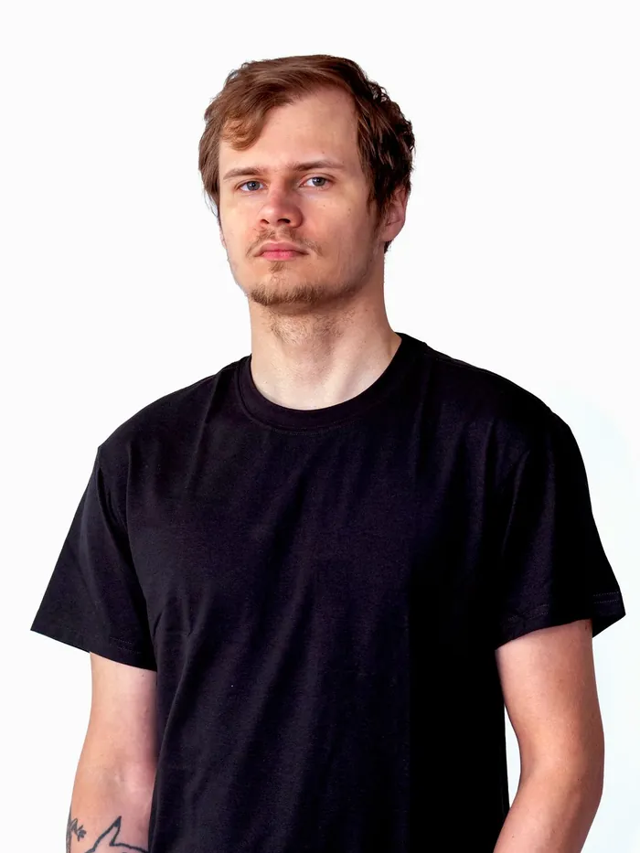 Before: receding hairline and thinning front on a young man, front view