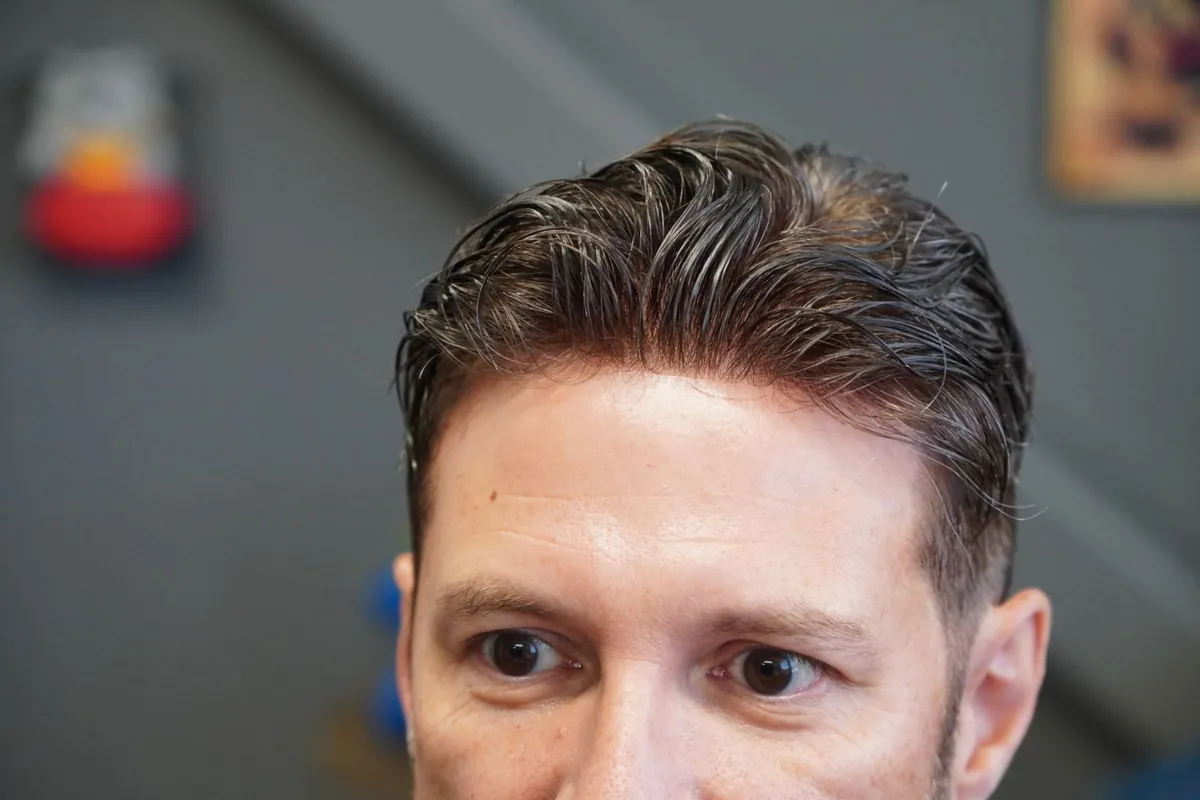 Close-up of the front hairline of a modern mens hair replacement system showing individual strands and a natural part