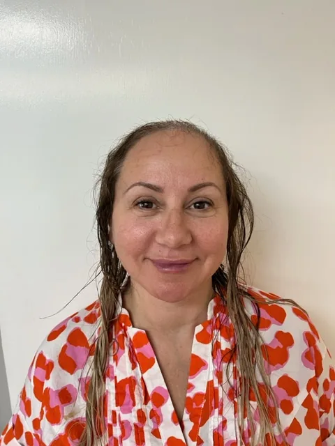 Tracy before: thinning hair and visible scalp from female hair loss, front view