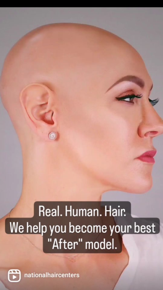 Let us help you get your best head of hair.

Surgical and non surgical hair replacement.

#alopeciaawareness 
#hairlosstreatment 
#hairrestoration 
#humanhairwig 
#houseofeuropeanhair